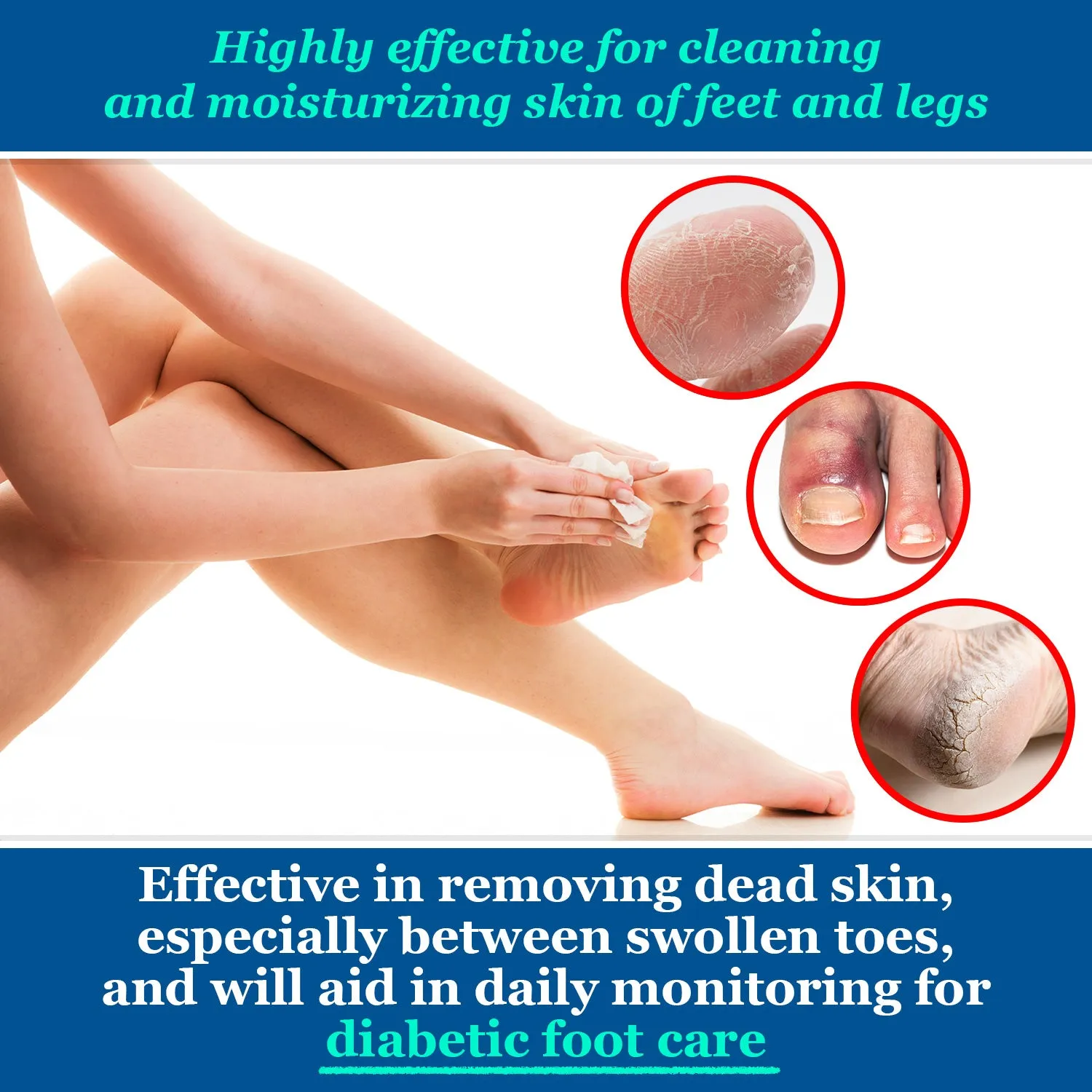(SPECIAL OFFER) pHeet® Antifungal & Antibacterial Foot Wipes
